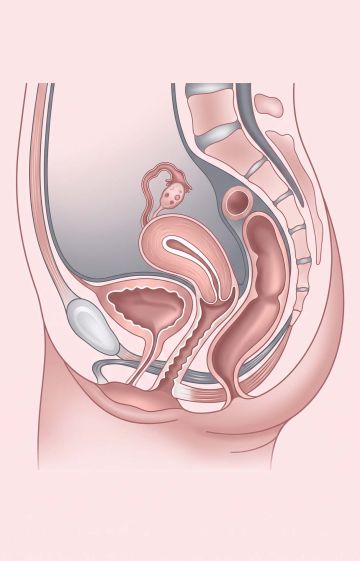 Medical cross-section diagram illustrating female pelvic and reproductive anatomical structures.